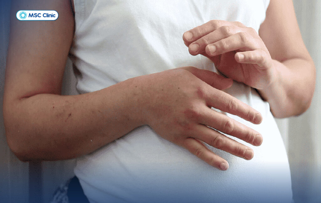 Tìm hiểu về viêm bao gân cổ tay và hướng điều trị hiệu quả, an toàn ...