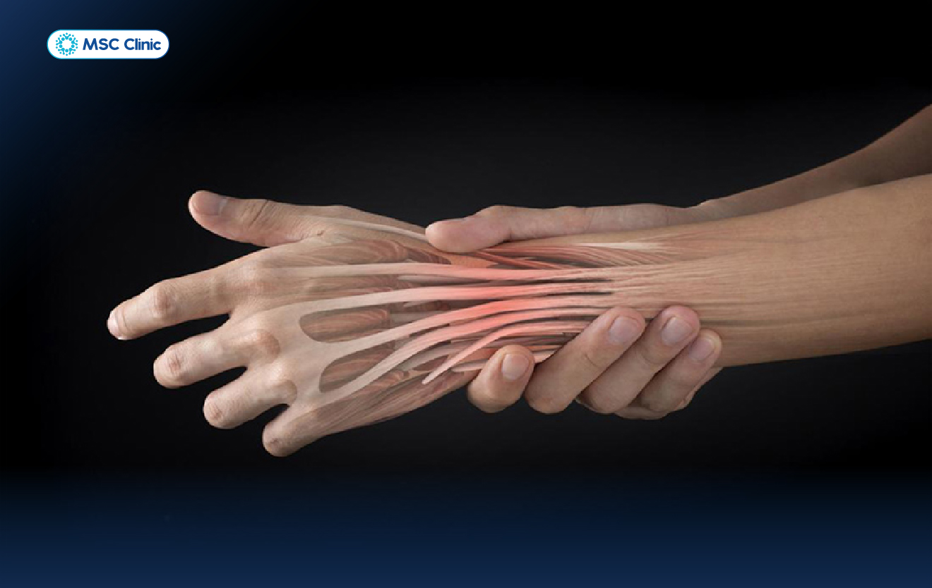 Viêm gân cổ tay - Cách chữa trị hiệu quả khi đôi tay kêu cứu-04