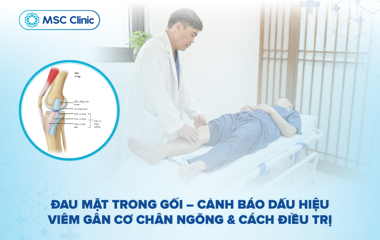 Viêm gân nên ăn gì và kiêng gì để phục hồi nhanh? - MSC Clinic