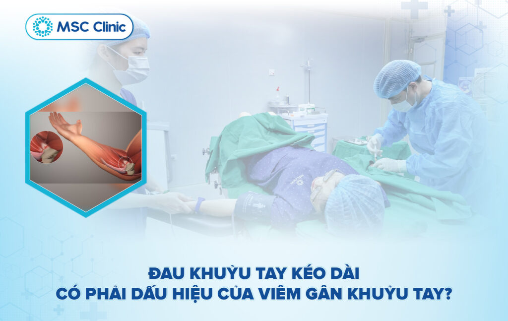 Viêm gân khuỷu tay: Nguyên nhân, dấu hiệu và cách điều trị