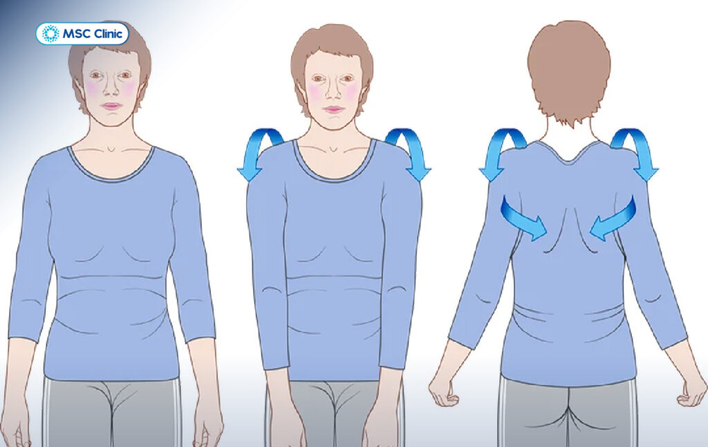 Viêm gân chóp xoay tập gì? 6 bài tập đơn giản – hiệu quả phục hồi chức ...