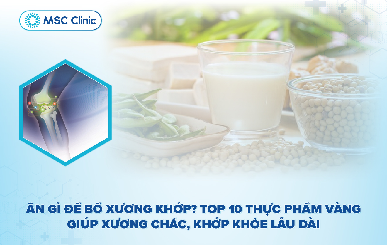 Ăn gì để bổ xương khớp Top 10 thực phẩm vàng giúp xương chắc, khớp khỏe lâu dài-02