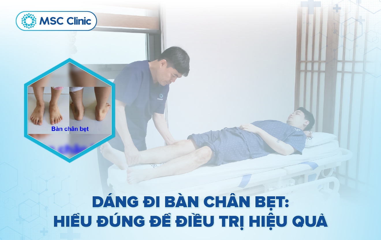 Dáng đi bàn chân bẹt Hiểu đúng để điều trị hiệu quả-02