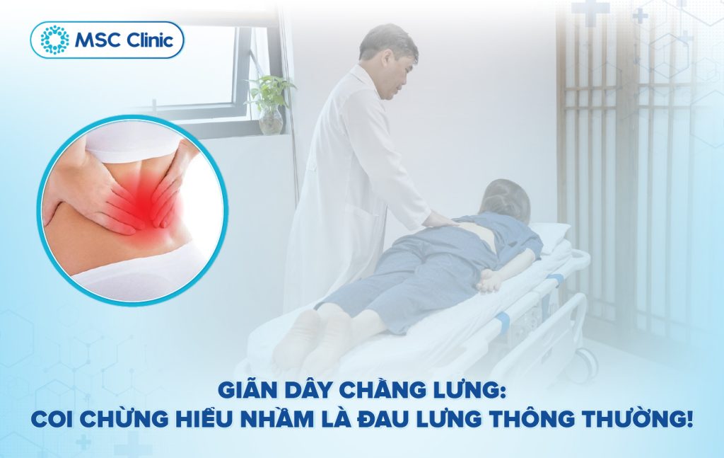 Giãn dây chằng lưng: Nguyên nhân và cách điều trị hiệu quả