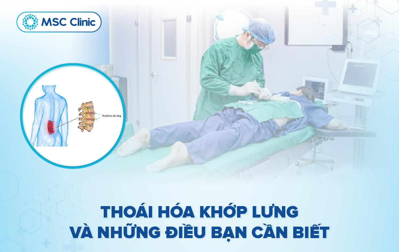 Thoái hóa khớp lưng và những điều bạn cần biết-01