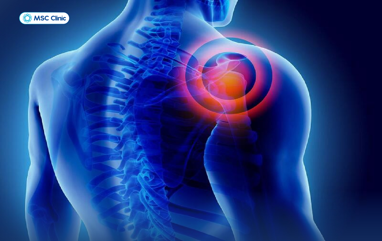 Đau vai khi đánh cầu lông nếu kéo dài quá 2 tuần cần đi thăm khám bác sĩ chuyên gia ngay