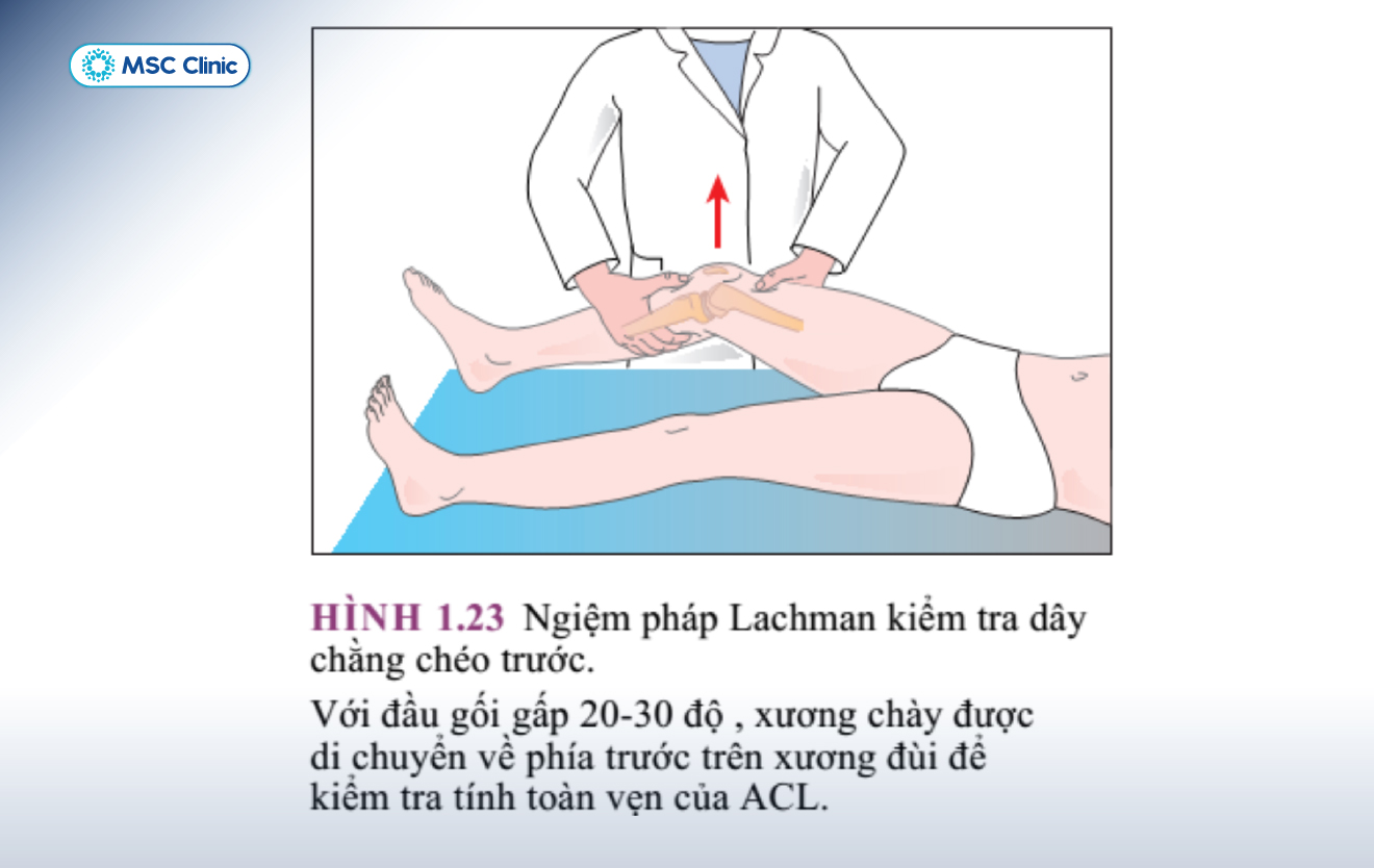 Bài kiểm tra Lachman thường được các bác sĩ áp dụng khi thăm khám lâm sàng