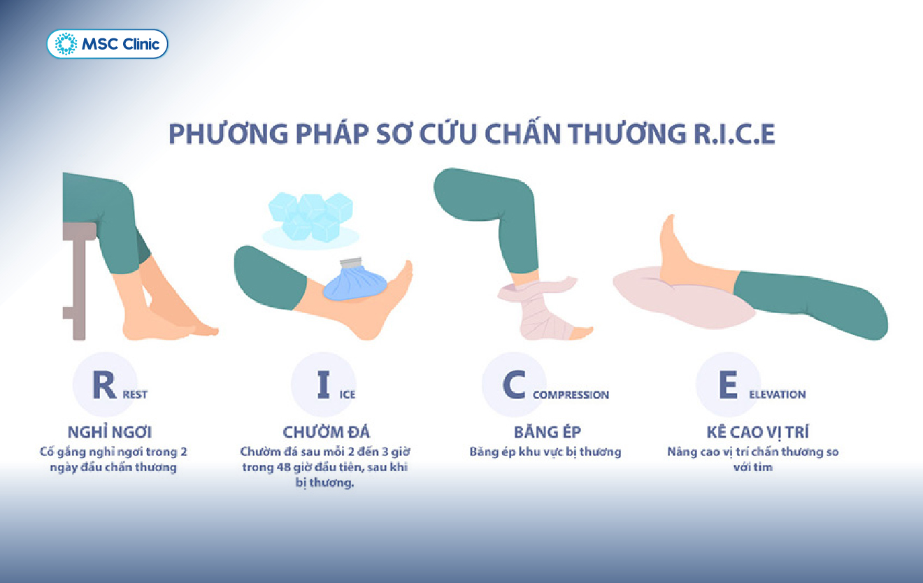 Liệu pháp R.I.C.E sơ cứu ban đầu giúp giảm đau tạm thời 