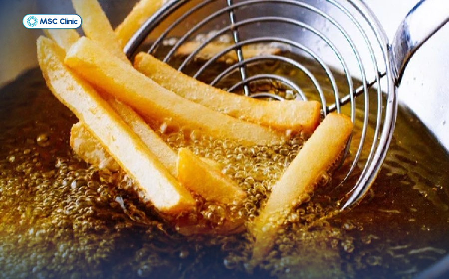 Bệnh gan kiêng ăn gì? Đầu tiên phải kể đến các thực phẩm nhiều dầu mỡ gây hại cho gan 