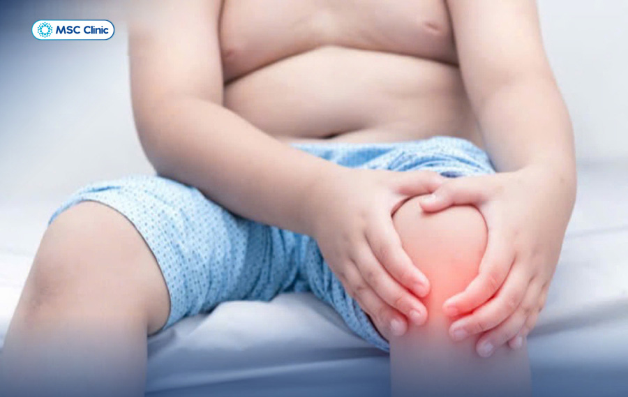 Thừa cân có thể khiến việc phục hồi viêm bao hoạt dịch gân chân ngỗng trở nên khó khăn hơn
