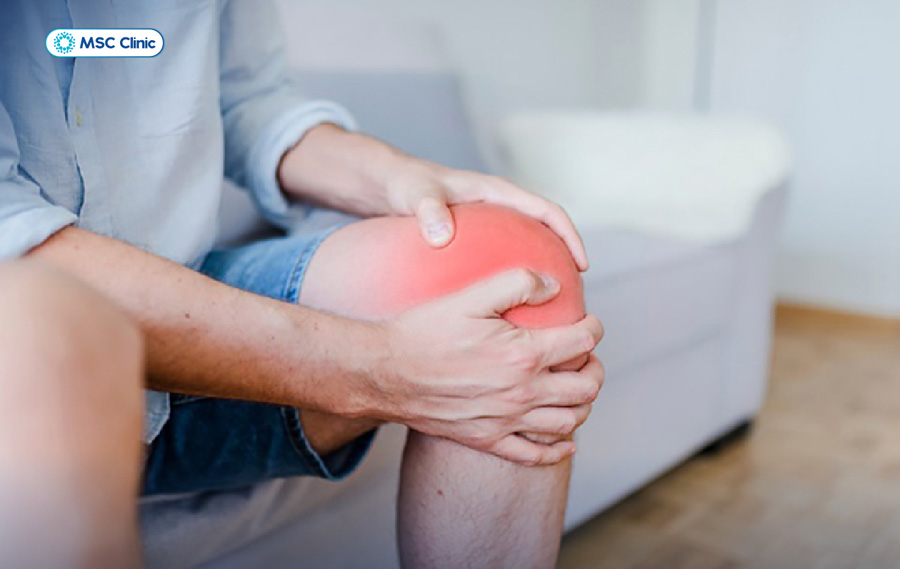 Sưng tấy thường đi kèm với cảm giác căng tức khớp gối
