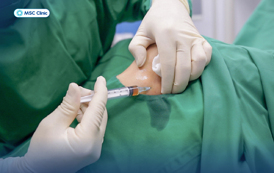 Quá trình tiêm nội khớp tại MSC Clinic được thực hiện điều kiện vô khuẩn, đảm bảo an toàn và hiệu quả cho người bệnh