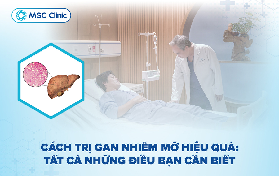 Cách trị gan nhiễm mỡ hiệu quả: Những điều bạn cần biết