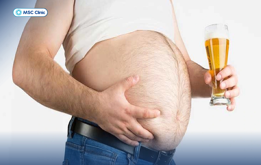 Rượu bia là nguyên nhân hàng đầu gây gan nhiễm mỡ