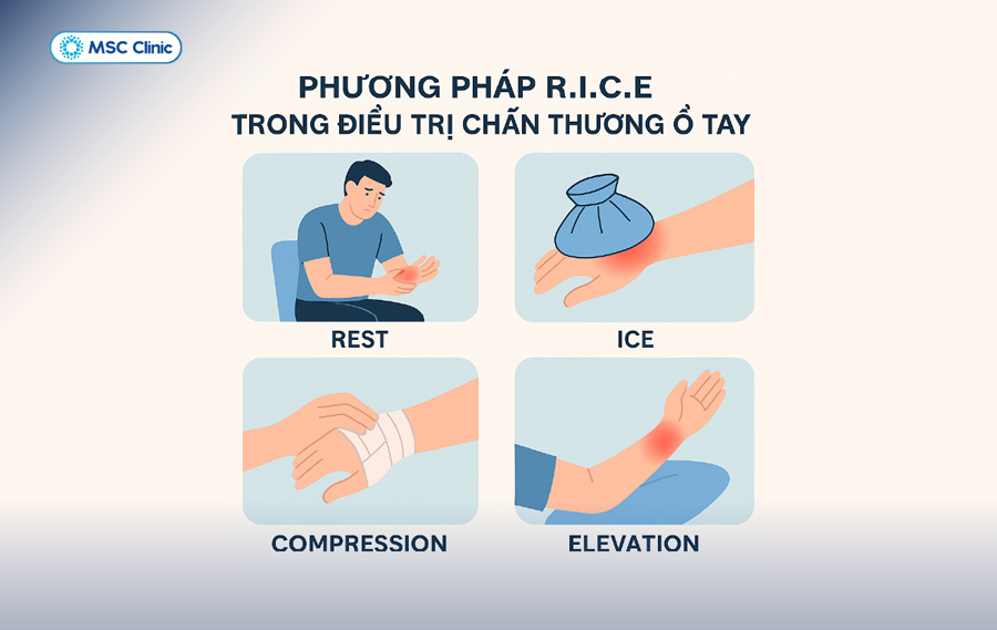 Thực hiện nguyên tắc R.I.C.E ngay sau khi cổ tay bị đau hoặc sưng sẽ giúp cải thiện đáng kể khả năng hồi phục