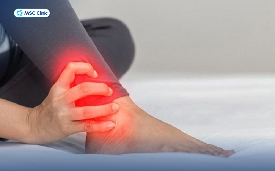 Đau cổ chân nhưng không sưng là bệnh gì? Tìm hiểu chi tiết trong bài viết sau