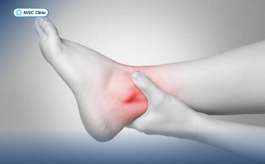 Đau cổ chân không sưng tuy không nguy hiểm ngay nhưng gây ảnh hưởng trực tiếp đến tầm vận động khớp cổ chân
