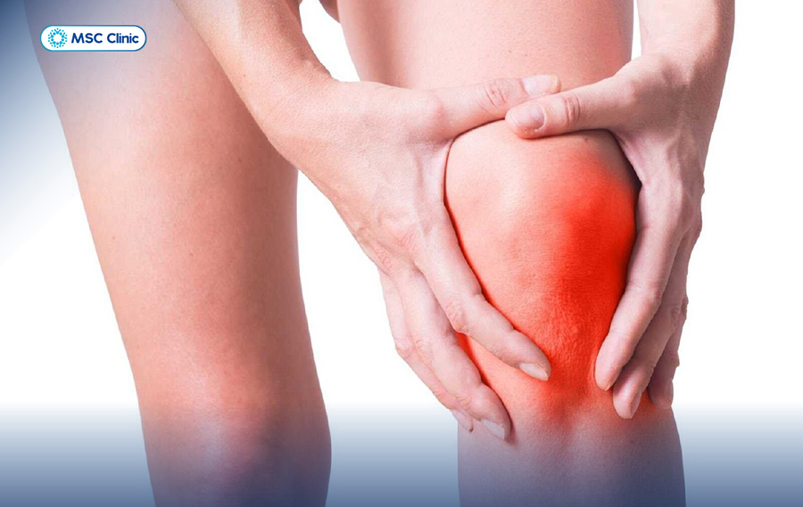 Khi bị đứt bán phần dây chằng chéo trước, bạn sẽ cảm thấy gối sưng đỏ nhanh chóng