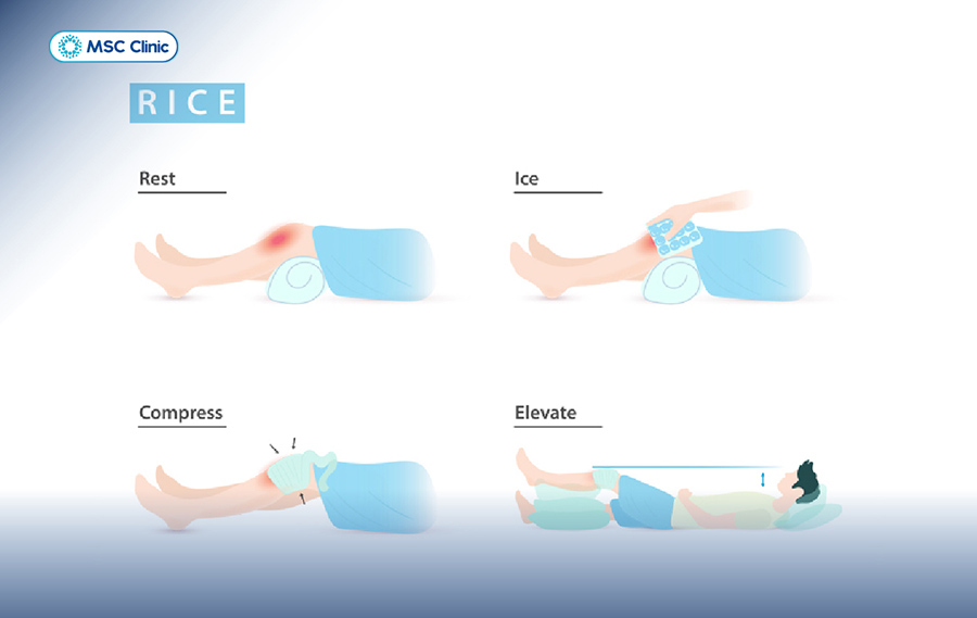 Phương pháp sơ cứu ban đầu R.I.C.E