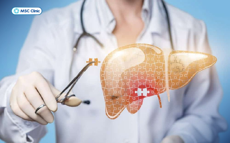 Ghép gan được chỉ định khi các biện pháp kiểm soát biến chứng không còn hiệu quả và gan mất khả năng tự phục hồi 