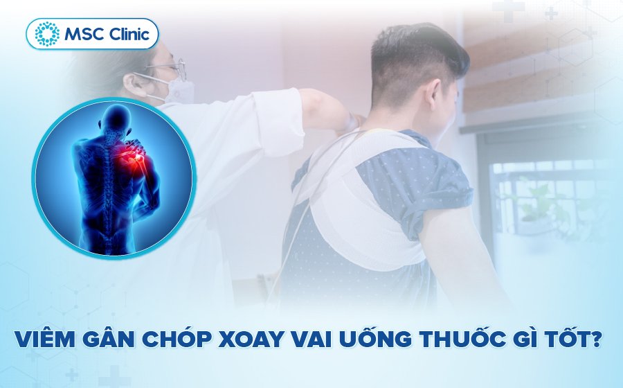 Viêm gân chóp xoay vai uống thuốc gì? Hướng dẫn an toàn & hiệu quả