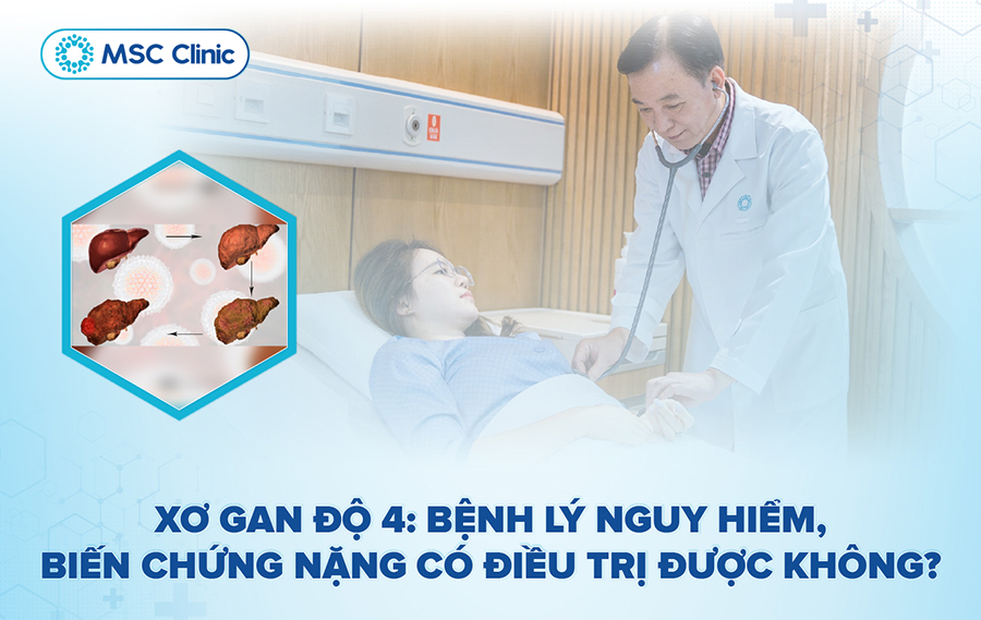 Xơ gan độ 4 là gì: Bệnh lý nguy hiểm, biến chứng nặng có điều trị được không?