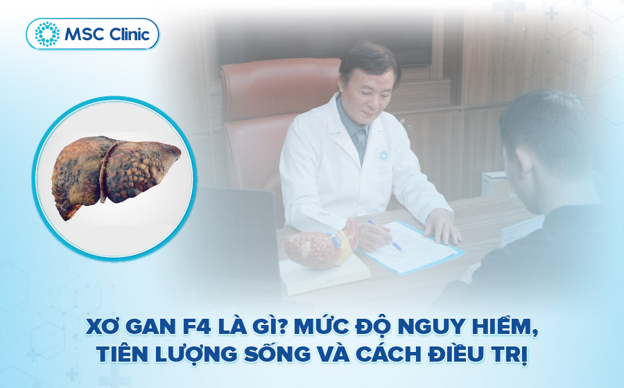 Xơ gan độ 4 là gì? Triệu chứng, tiên lượng sống và điều trị