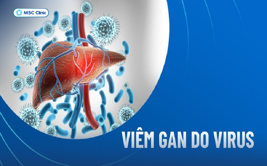 Bệnh gan có lây không và lây truyền qua đường nào-04
