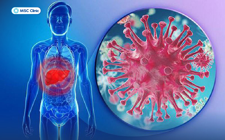 Bệnh gan có lây không và lây truyền qua đường nào-06