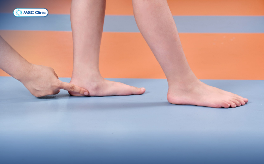 Cách chữa bàn chân bẹt tại nhà an toàn, dễ thực hiện-03