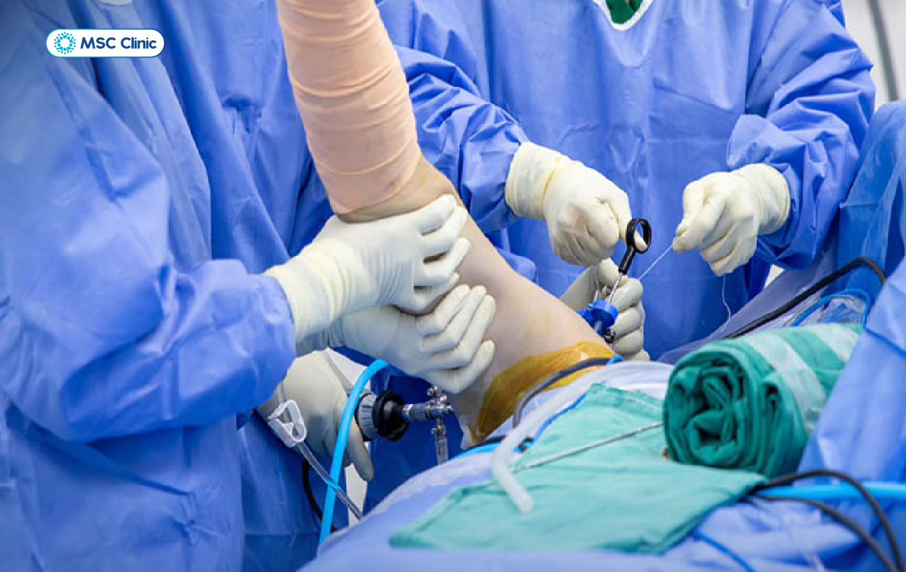 Viêm gân cơ nhị đầu Nguyên nhân, triệu chứng và cách điều trị hiệu quả-08