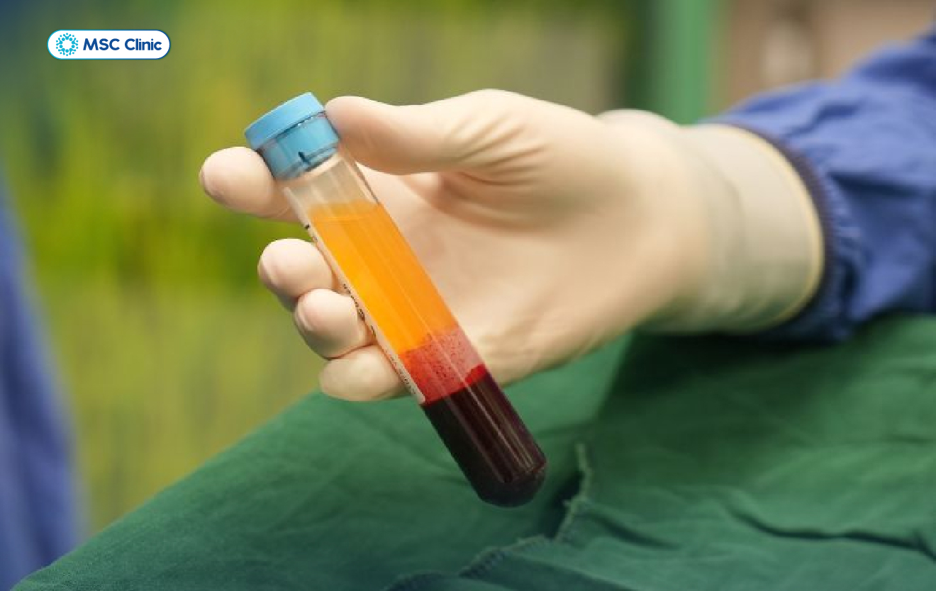 Liệu pháp huyết tương giàu tiểu cầu PRP mang lại nhiều lợi ích cho bệnh nhân giãn dây chằng cổ