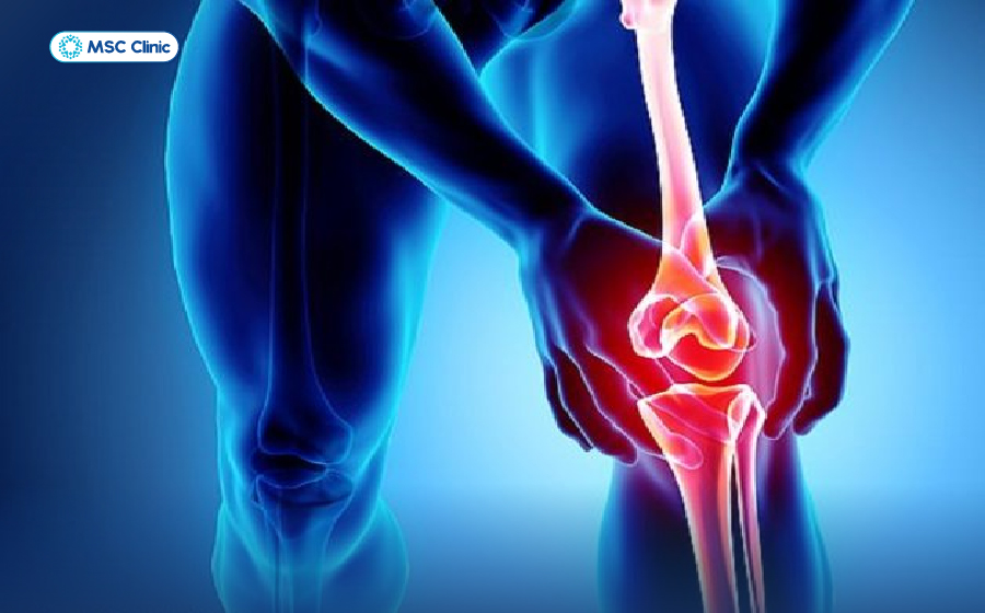 Nguyên nhân viêm khớp gối và cách điều trị an toàn-03