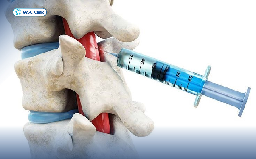 Thoái hóa cột sống và thoát vị đĩa đệm-13