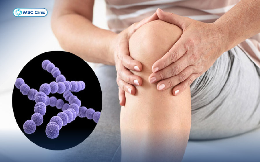 Viêm Khớp Nguyên nhân, triệu chứng và cách điều trị-07