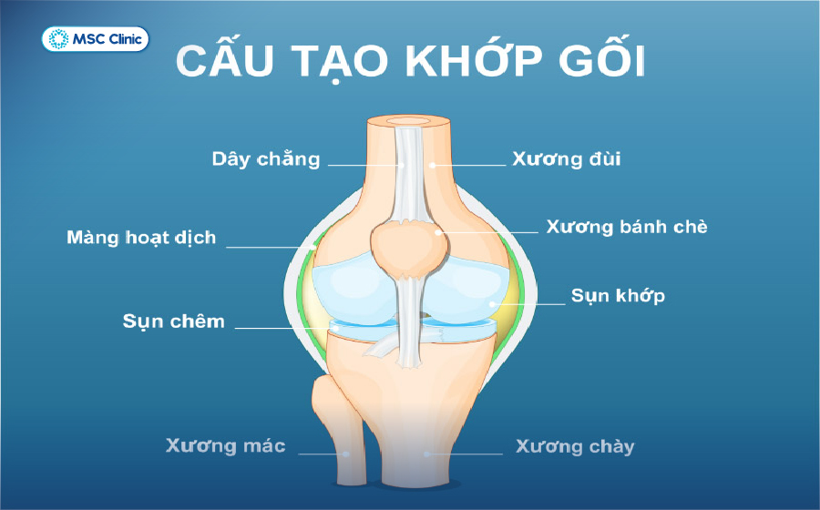 Viêm khớp gối Nguyên nhân, triệu chứng và hướng xử lý hiệu quả-04