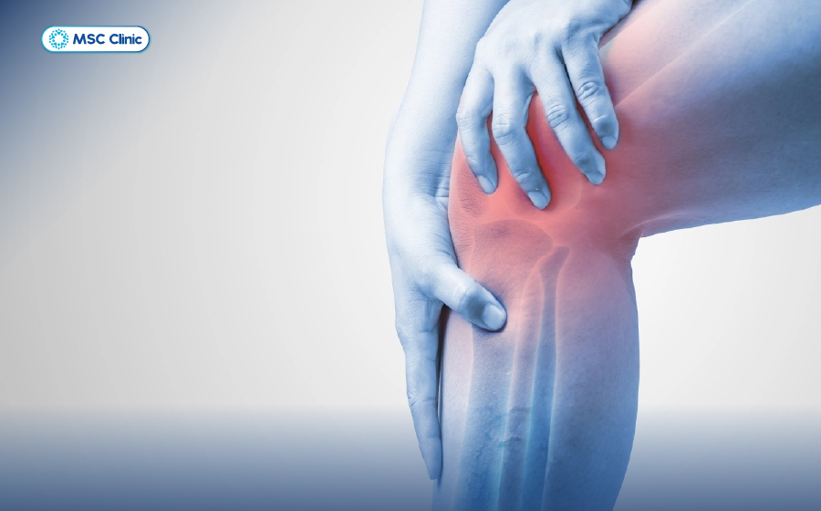 Viêm khớp gối Nguyên nhân, triệu chứng và hướng xử lý hiệu quả-06