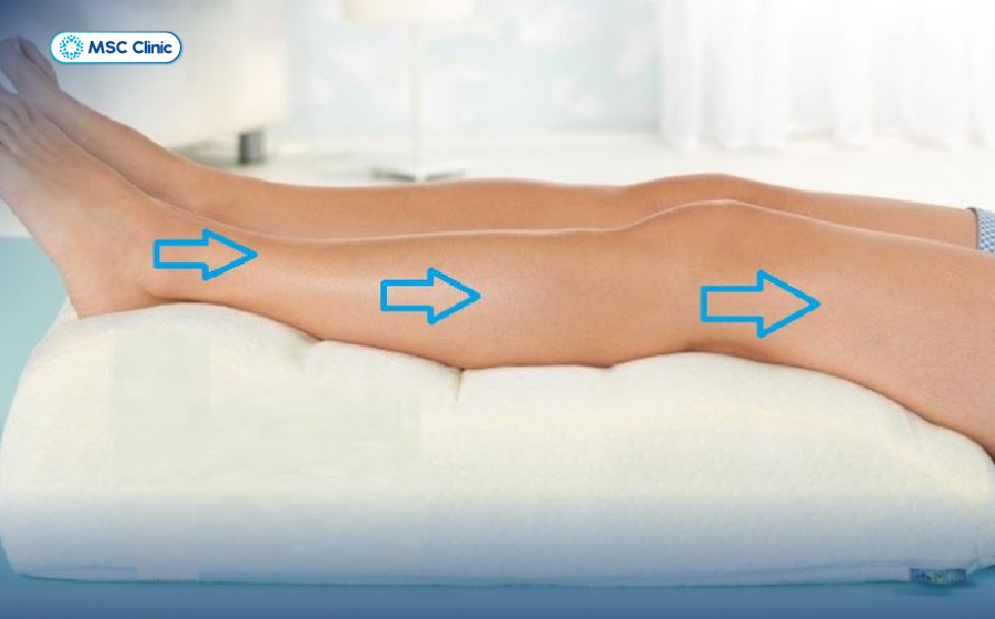 Viêm khớp gối Nguyên nhân, triệu chứng và hướng xử lý hiệu quả-12