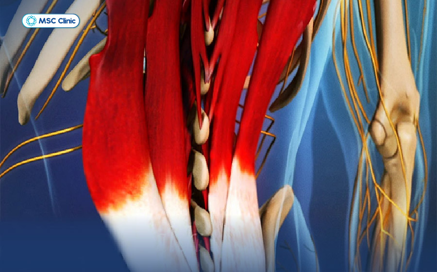 Đau lưng bên phải là bệnh gì-06