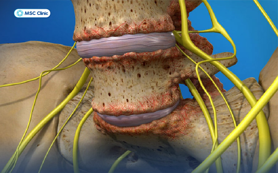 Đau lưng bên phải là bệnh gì-09