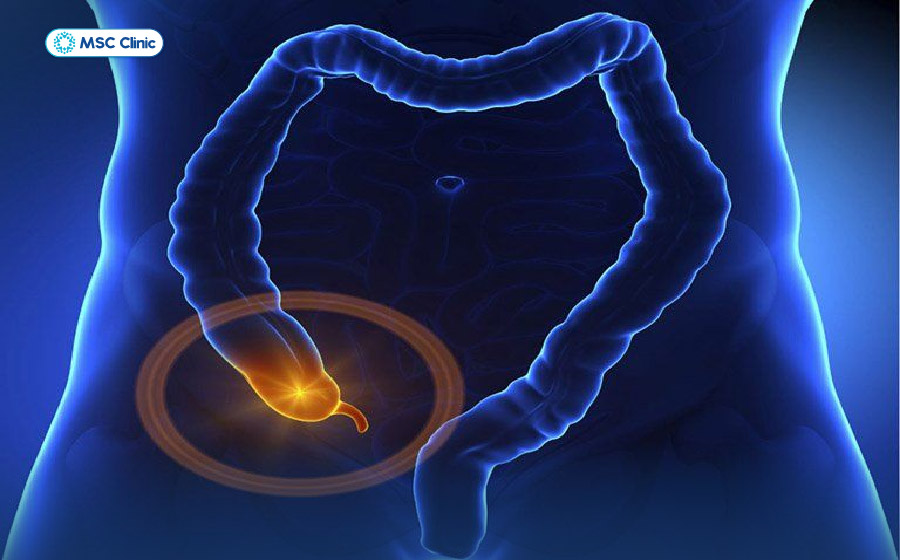 Đau lưng bên phải là bệnh gì-11