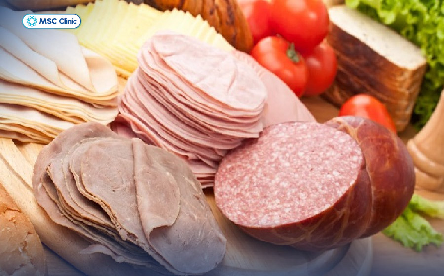 Tràn dịch khớp gối kiêng ăn gì-05