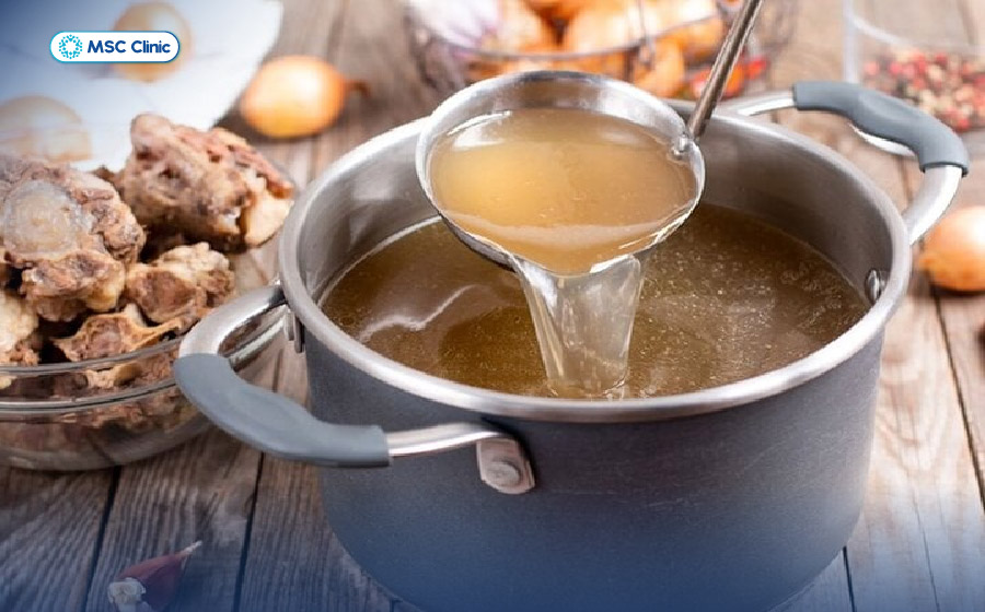 Tràn dịch khớp gối kiêng ăn gì-12