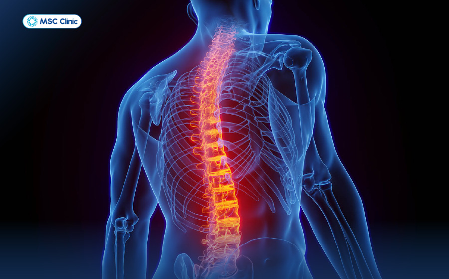 Đau lưng bên trái-05