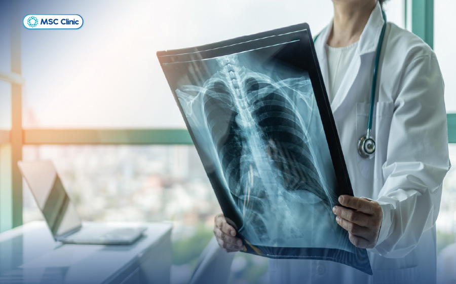 Đau lưng bên trái-09