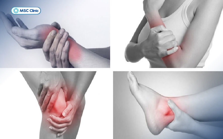 Viêm đa khớp Nguyên nhân, triệu chứng và điều trị-03