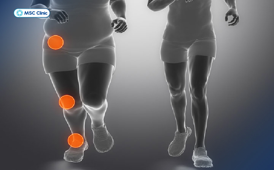 Viêm đa khớp Nguyên nhân, triệu chứng và điều trị-07