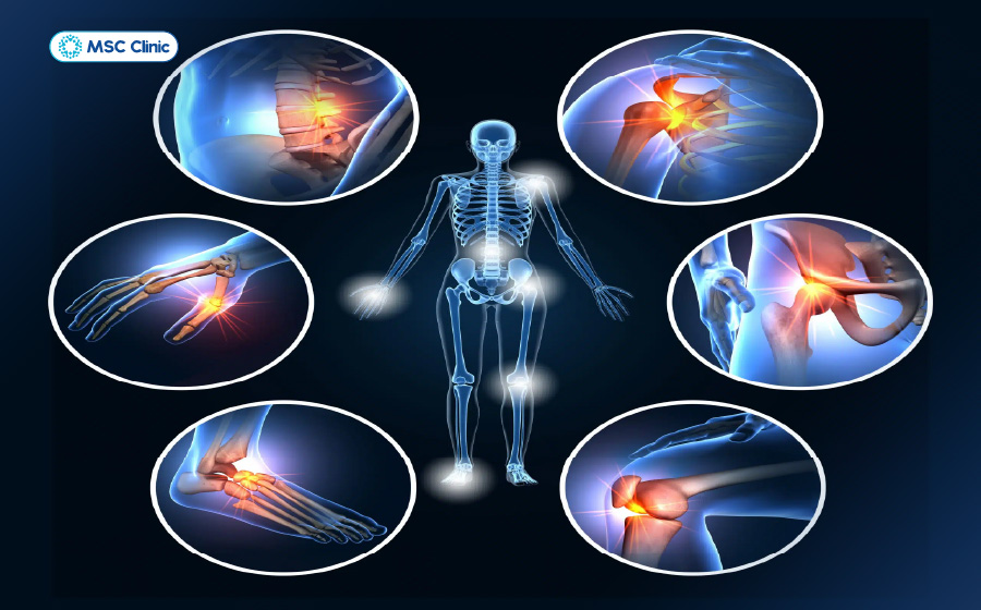 Viêm đa khớp Nguyên nhân, triệu chứng và điều trị-08