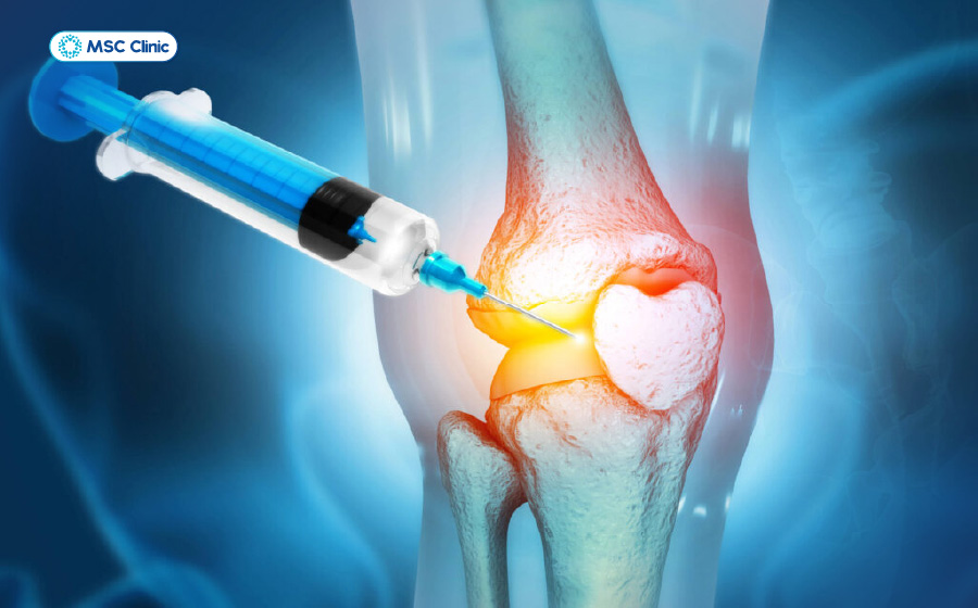 Viêm đa khớp Nguyên nhân, triệu chứng và điều trị-13