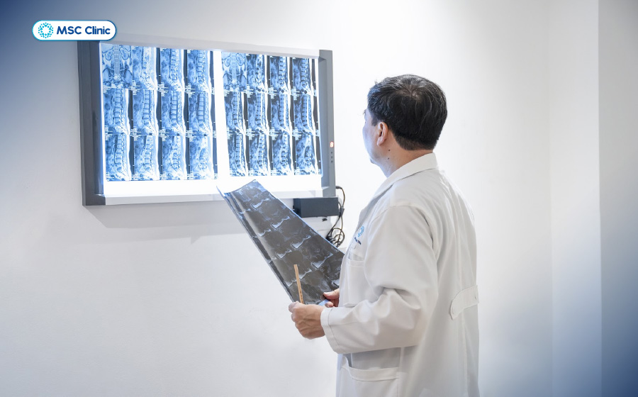 Viêm đa khớp Nguyên nhân, triệu chứng và điều trị-16